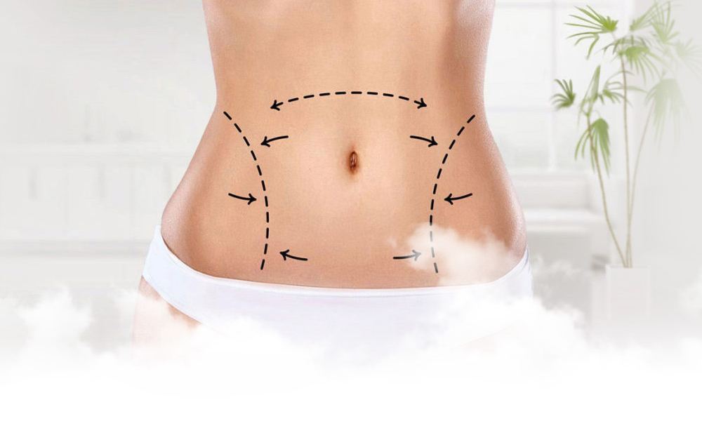 Karın Germe (Abdominoplasti)